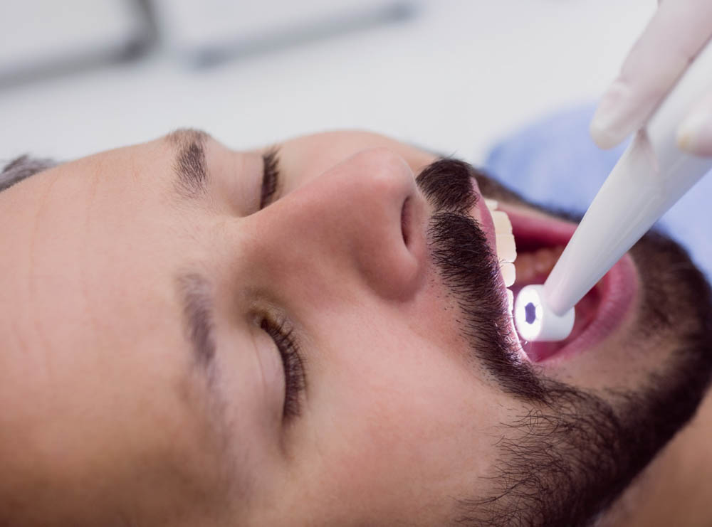 dental filling and tooth decay