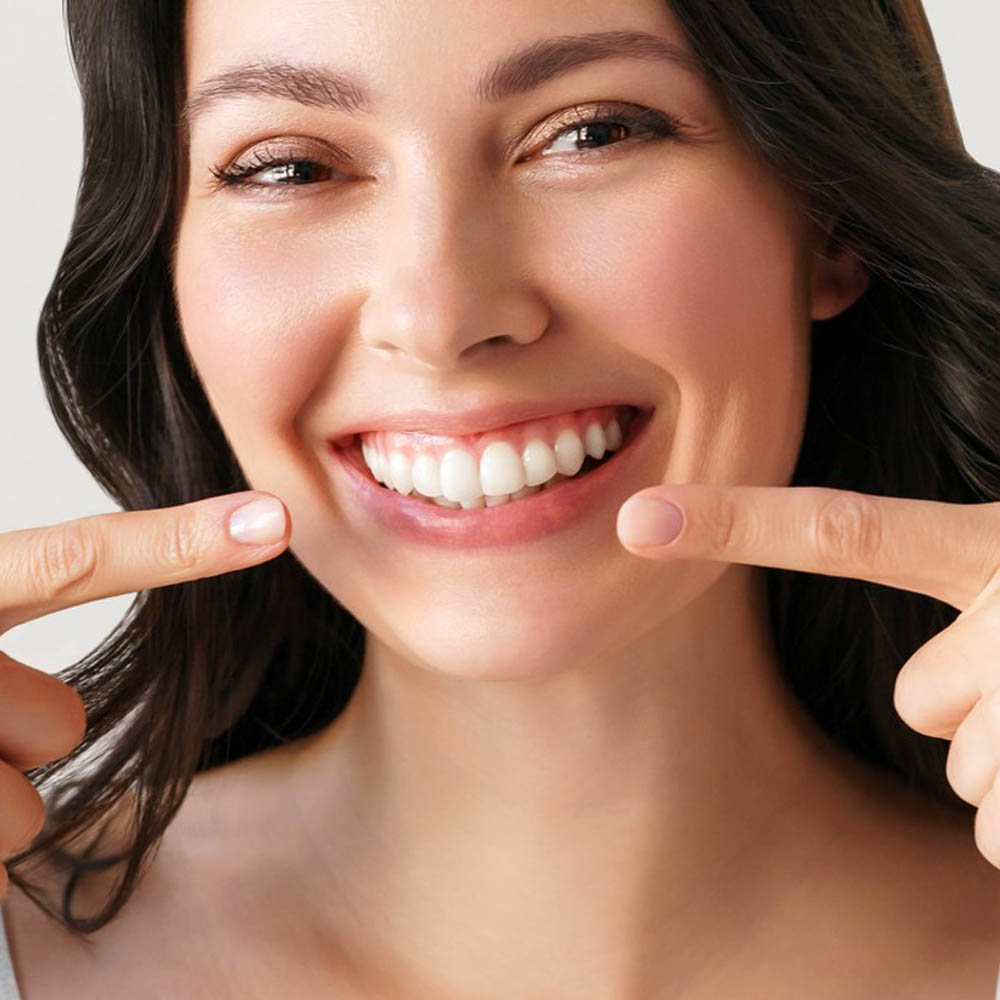 teeth whitening maintenance